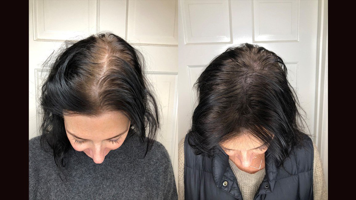 hair treatment
